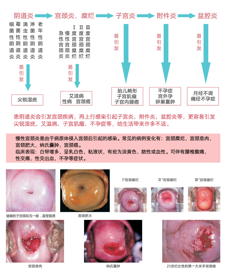 佳茵